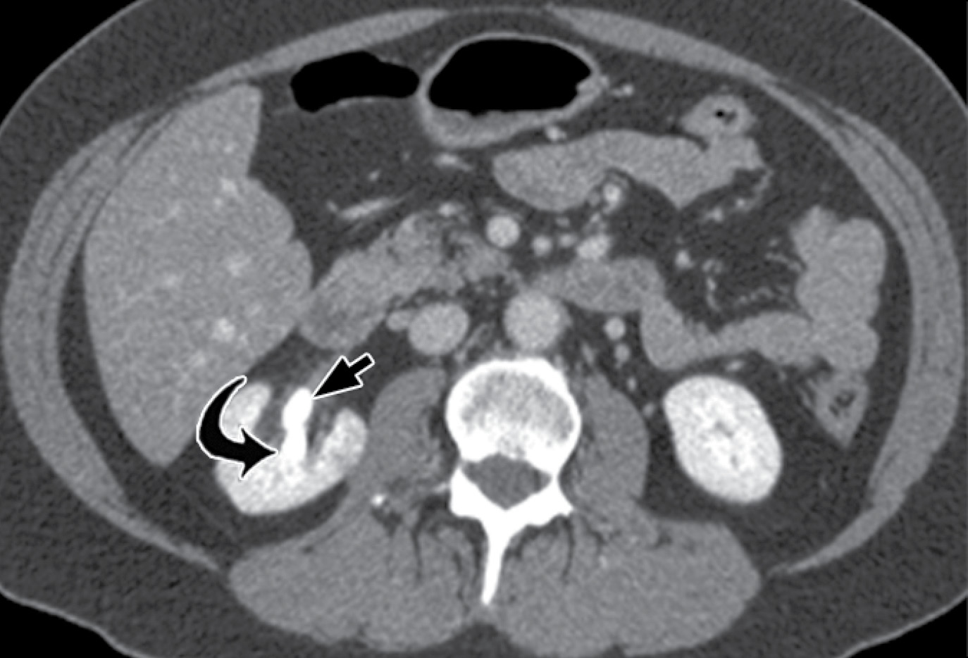 Effectiveness of VNC imaging in clinical practice